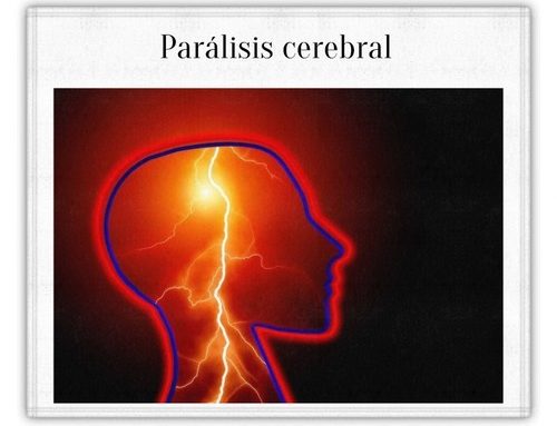 Fisioterapia para parálisis cerebral