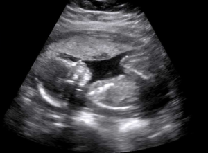 Se producen alrededor del momento de la concepción o durante el desarrollo temprano del feto.